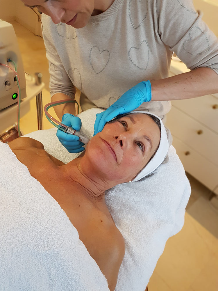 Rodin Beautycenter - Microdermabrasie