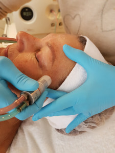 Rodin Beautycenter - Microdermabrasie